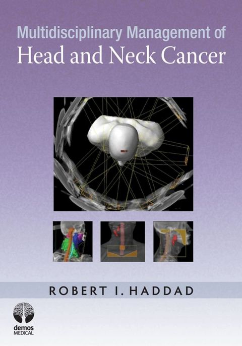 Multidisciplinary Management of Head and Neck Cancer(Kobo/電子書)