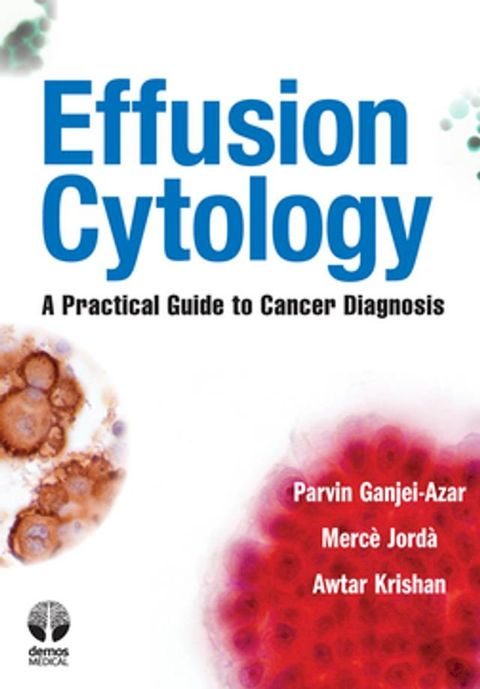 Effusion Cytology(Kobo/電子書)