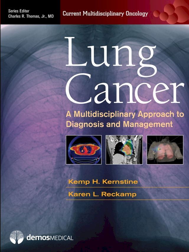  Lung Cancer(Kobo/電子書)