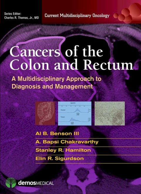 Cancers of the Colon and Rectum(Kobo/電子書)