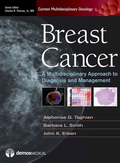 Breast Cancer(Kobo/電子書)