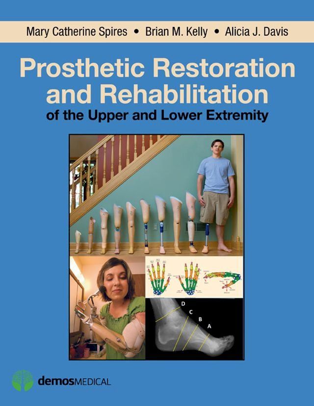  Prosthetic Restoration and Rehabilitation of the Upper and Lower Extremity(Kobo/電子書)