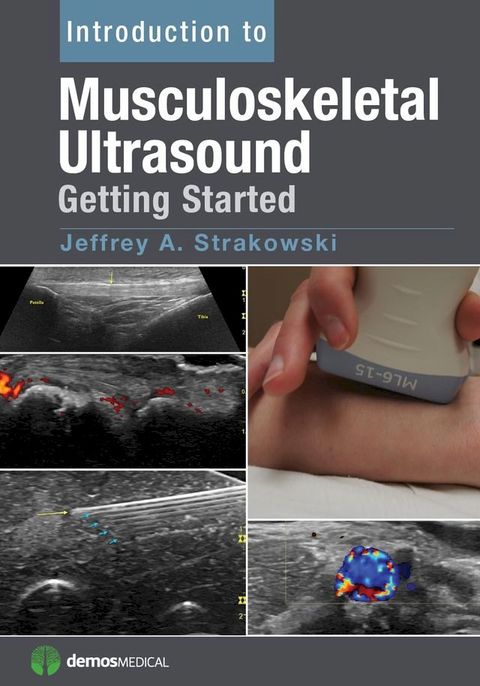 Introduction to Musculoskeletal Ultrasound(Kobo/電子書)