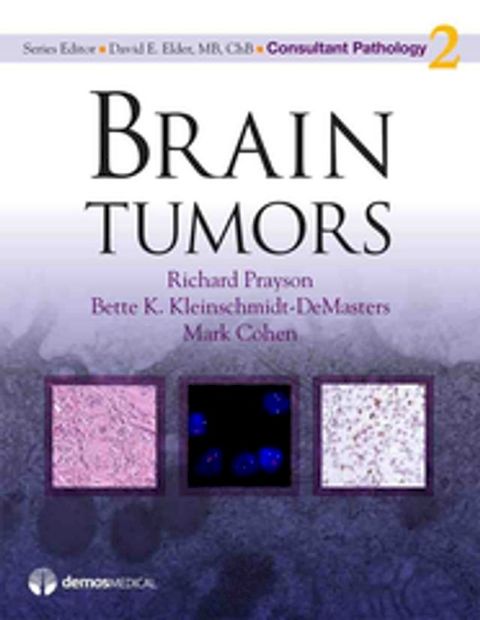 Brain Tumors(Kobo/電子書)