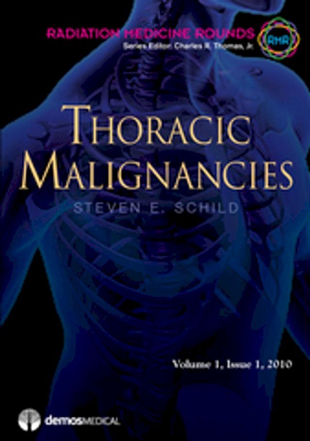  Thoracic Malignancies(Kobo/電子書)