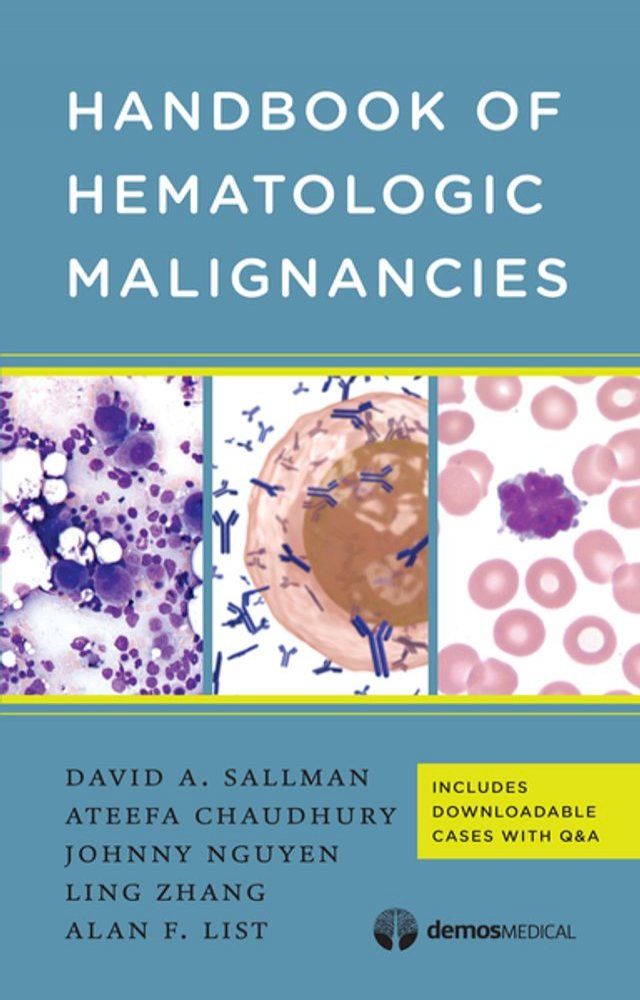  Handbook of Hematologic Malignancies(Kobo/電子書)