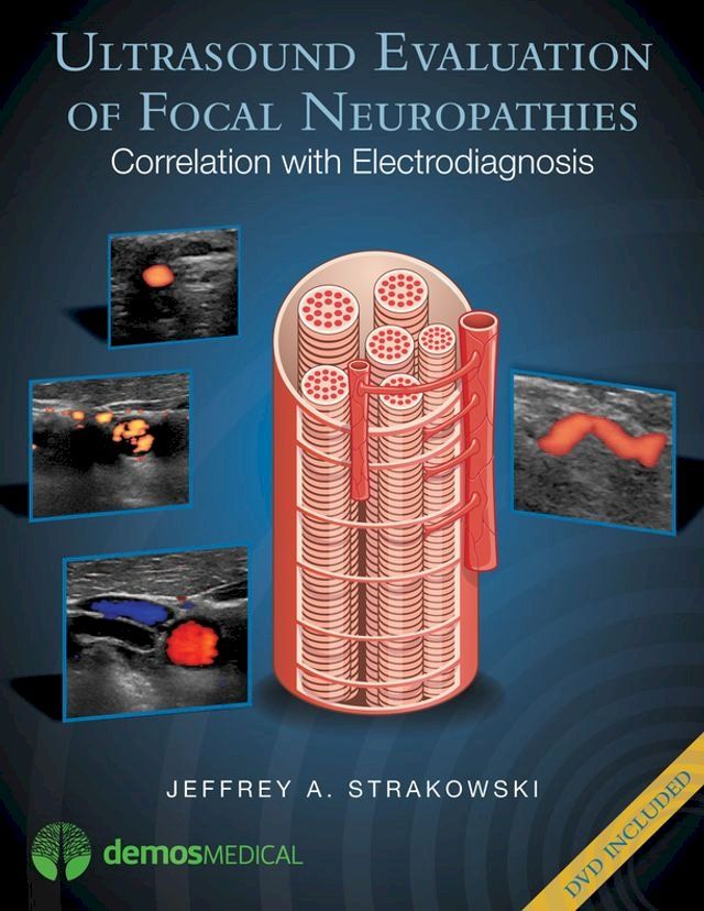  Ultrasound Evaluation of Focal Neuropathies(Kobo/電子書)