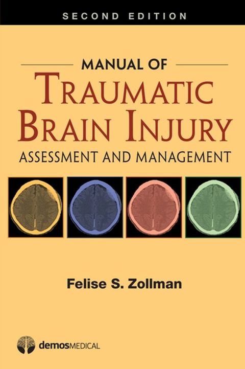 Manual of Traumatic Brain Injury(Kobo/電子書)