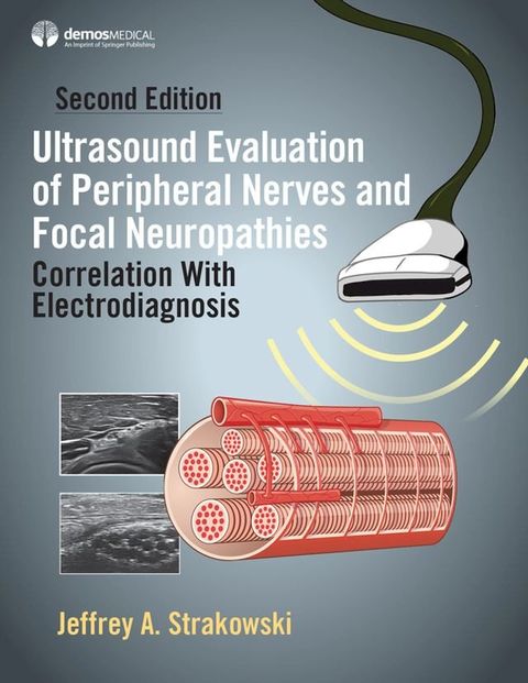 Ultrasound Evaluation of Peripheral Nerves and Focal Neuropathies, Second Edition(Kobo/電子書)