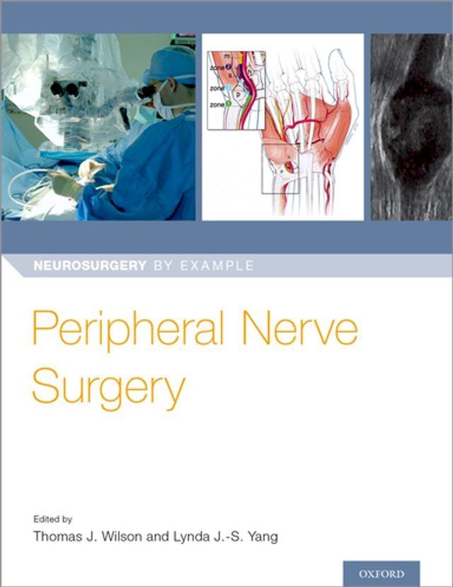  Peripheral Nerve Surgery(Kobo/電子書)