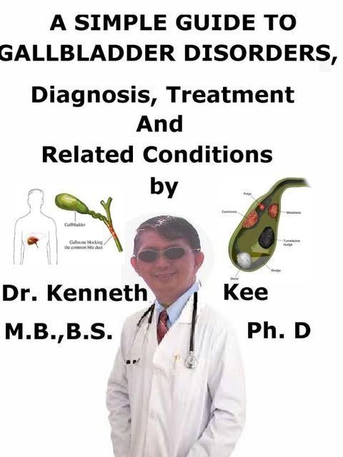 A Simple Guide to Gallbladder Disorders, Diagnosis, Treatment and Related Conditions(Kobo/電子書)