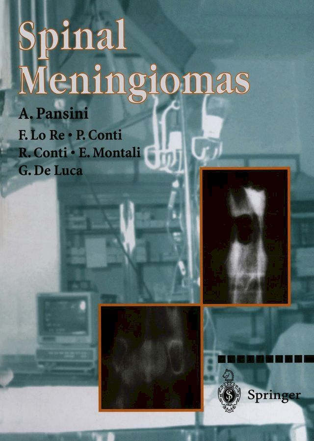  Spinal Meningiomas(Kobo/電子書)