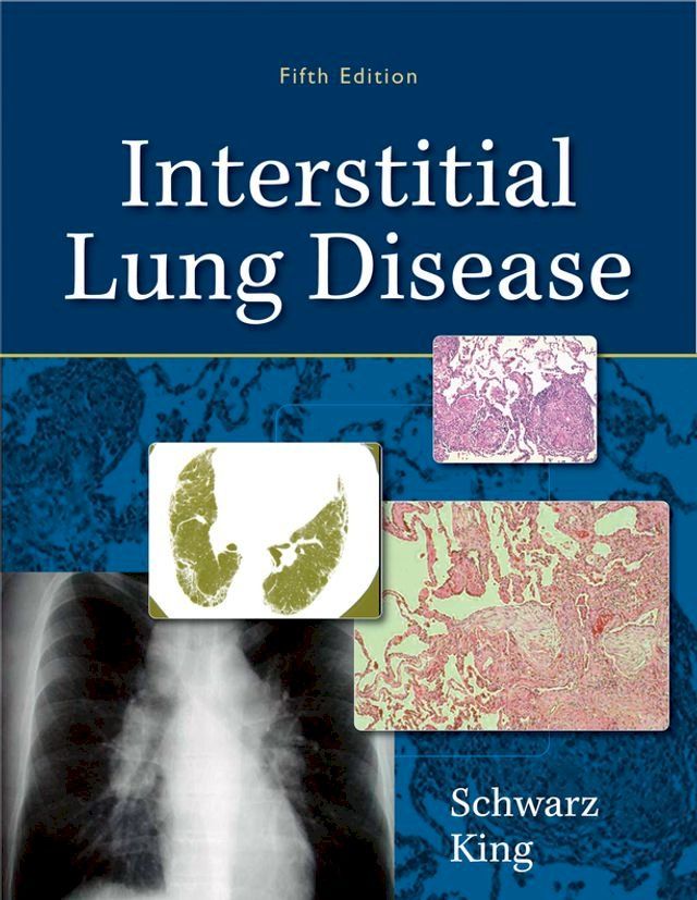  Interstitial Lung Disease(Kobo/電子書)