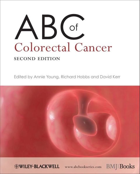 ABC of Colorectal Cancer(Kobo/電子書)