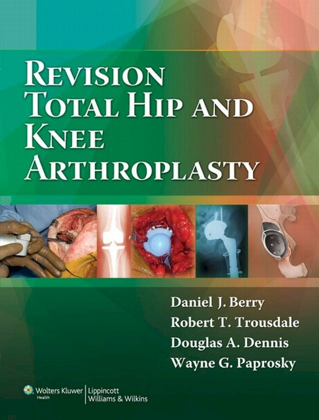  Revision Total Hip and Knee Arthroplasty(Kobo/電子書)