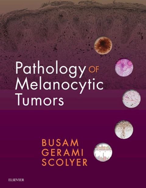 Pathology of Melanocytic Tumors(Kobo/電子書)