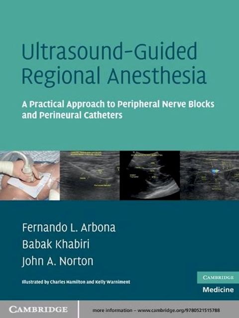 Ultrasound-Guided Regional Anesthesia(Kobo/電子書)