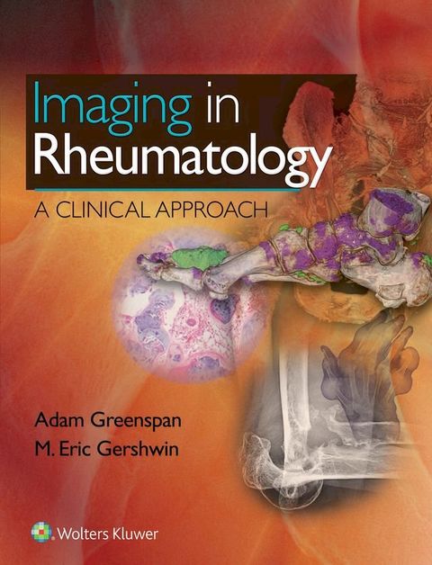 Imaging in Rheumatology(Kobo/電子書)