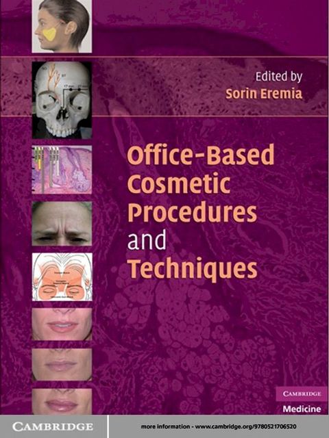 Office-Based Cosmetic Procedures and Techniques(Kobo/電子書)