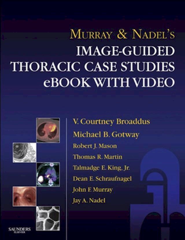  Murray & Nadel’s Image-Guided Thoracic Case Studies - E-Book with Video(Kobo/電子書)