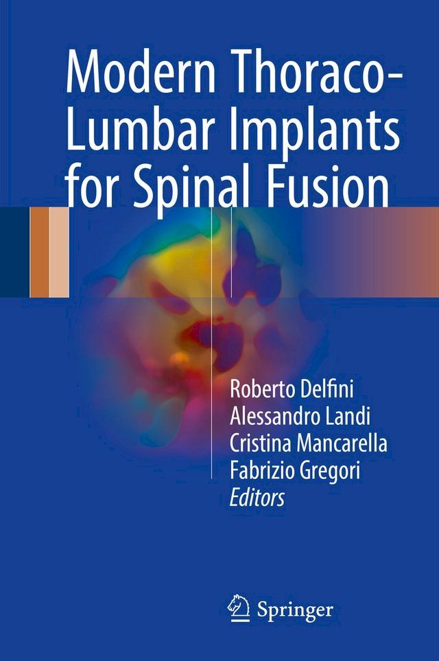  Modern Thoraco-Lumbar Implants for Spinal Fusion(Kobo/電子書)