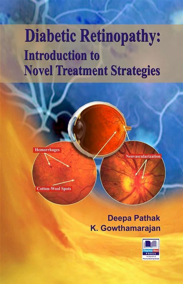  Diabetic Retinopathy(Kobo/電子書)