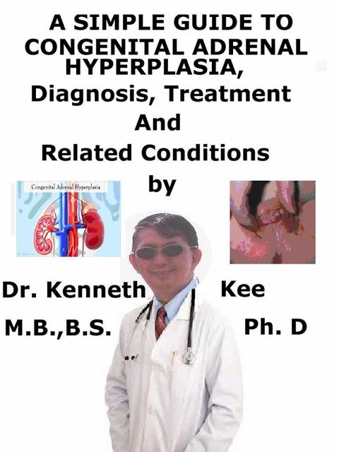 A Simple Guide to Congenital Adrenal Hyperplasia, Diagnosis, Treatment and Related Conditions(Kobo/電子書)