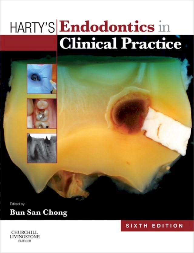  Harty's Endodontics in Clinical Practice(Kobo/電子書)