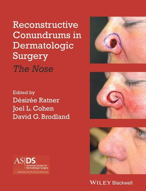 Reconstructive Conundrums in Dermatologic Surgery(Kobo/電子書)