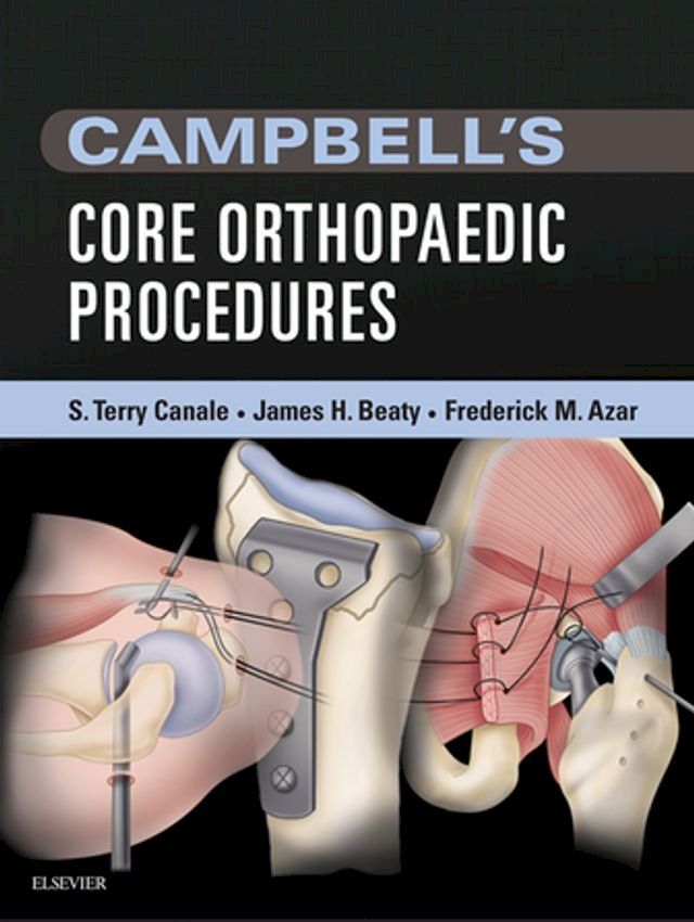  Campbell's Core Orthopaedic Procedures(Kobo/電子書)