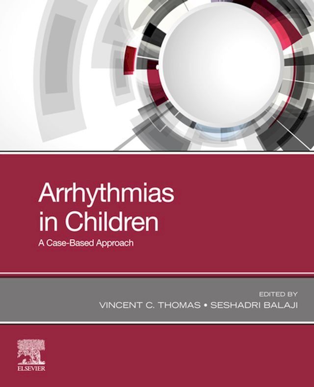  Arrhythmias in Children(Kobo/電子書)