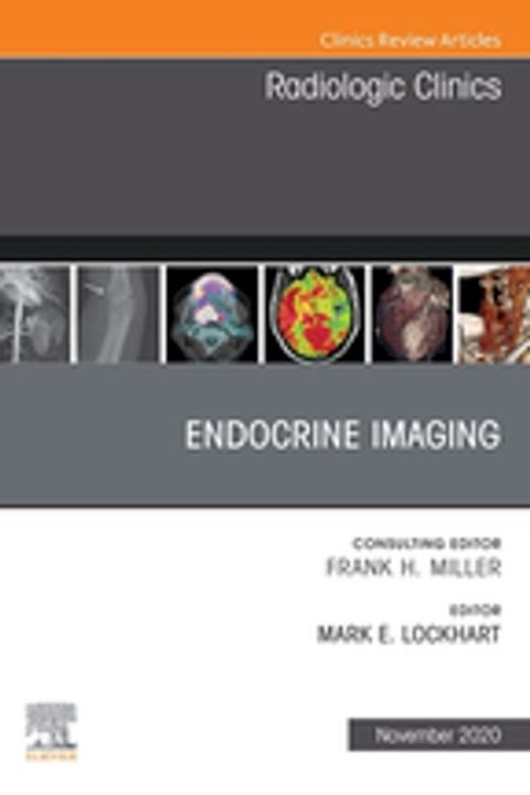 Endocrine Imaging, An Issue of Radiologic Clinics of North America, E-Book(Kobo/電子書)