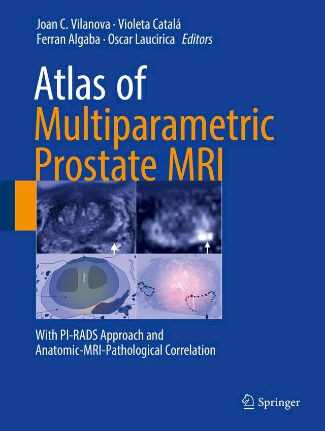  Atlas of Multiparametric Prostate MRI(Kobo/電子書)