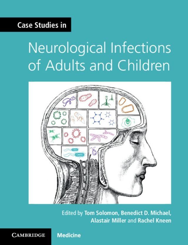  Case Studies in Neurological Infections of Adults and Children(Kobo/電子書)