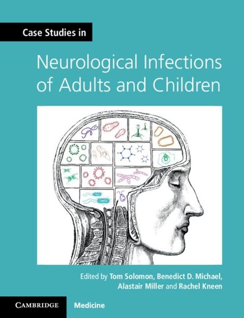 Case Studies in Neurological Infections of Adults and Children(Kobo/電子書)