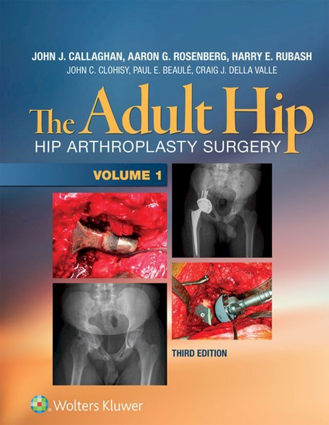  The Adult Hip(Kobo/電子書)