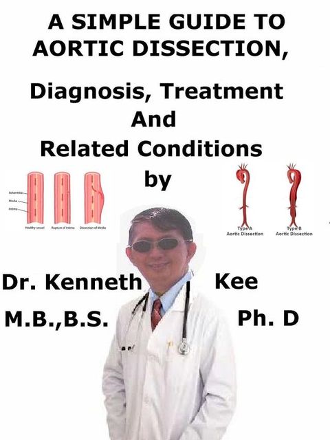 A Simple Guide to Aortic Dissection, Diagnosis, Treatment and Related Conditions(Kobo/電子書)