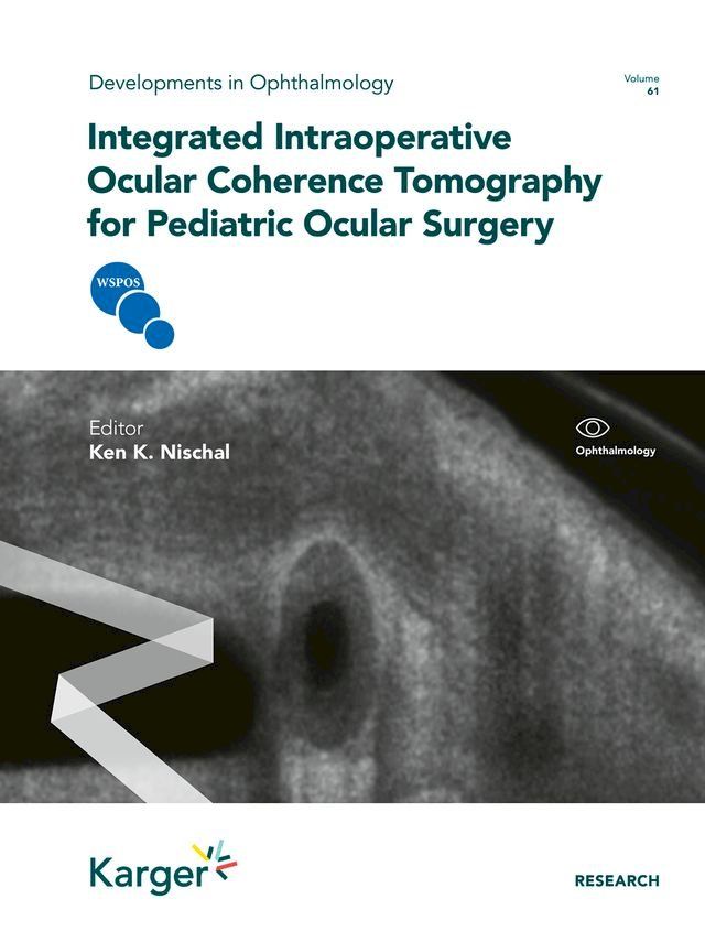  Integrated Intraoperative Ocular Coherence Tomography for Pediatric Ocular Surgery(Kobo/電子書)