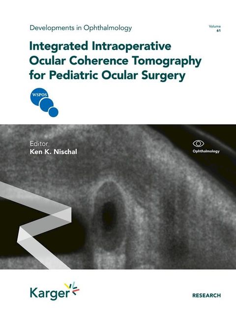 Integrated Intraoperative Ocular Coherence Tomography for Pediatric Ocular Surgery(Kobo/電子書)