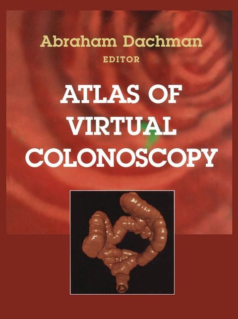 Atlas of Virtual Colonoscopy(Kobo/電子書)