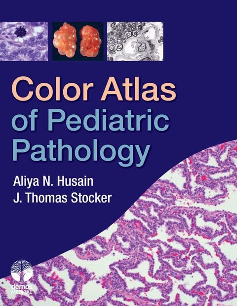 Color Atlas of Pediatric Pathology(Kobo/電子書)