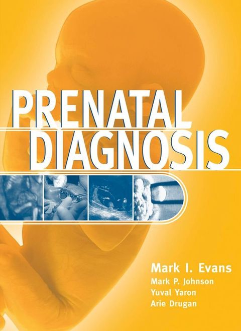 Prenatal Diagnosis(Kobo/電子書)