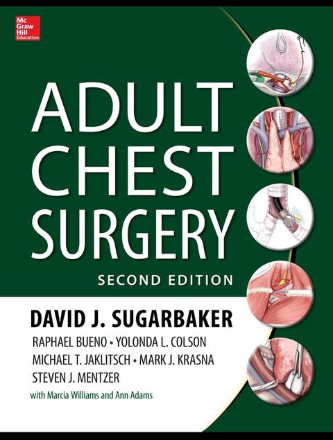 Adult Chest Surgery, 2nd edition(Kobo/電子書)