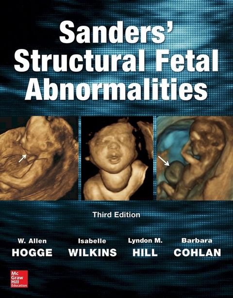 Sanders' Structural Fetal Abnormalities, Third Edition(Kobo/電子書)