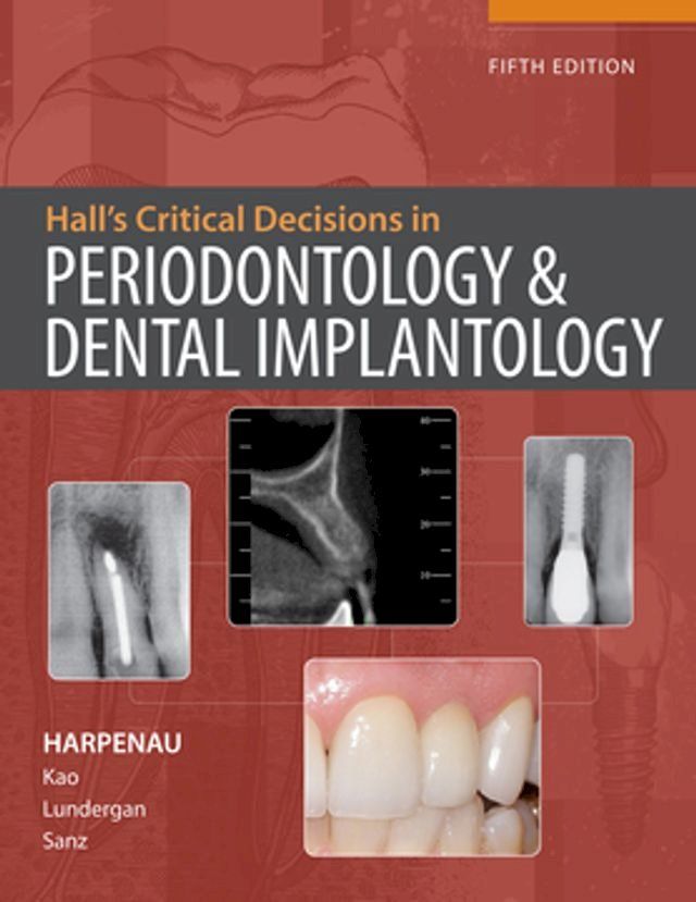  Hall's Critical Decisions in Periodontology & Dental Implantology, 5e(Kobo/電子書)