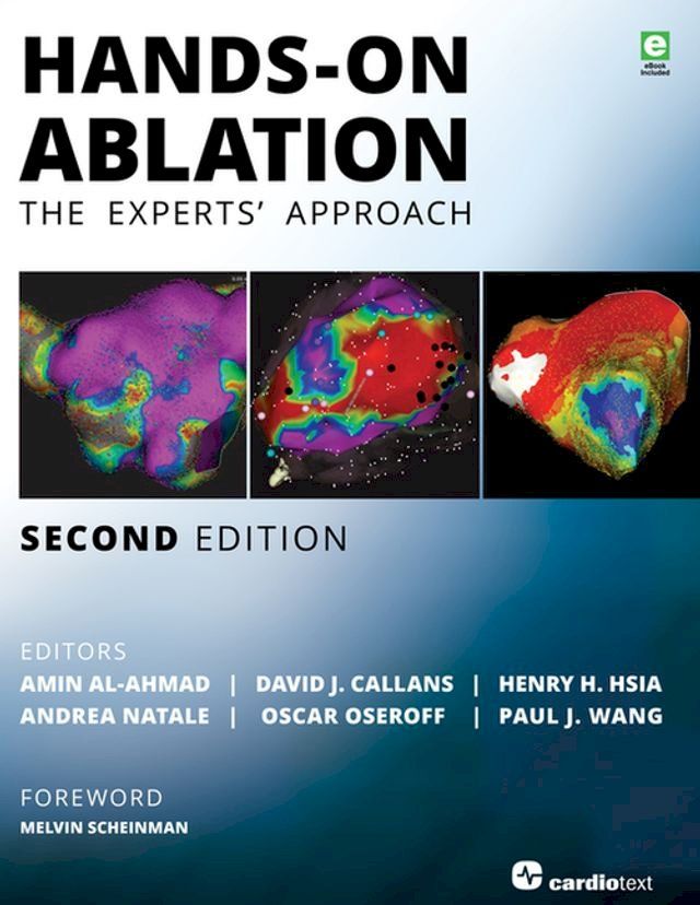  Hands-On Ablation(Kobo/電子書)