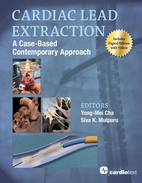 Cardiac Lead Extraction: A Case-Based Contemporary Approach(Kobo/電子書)