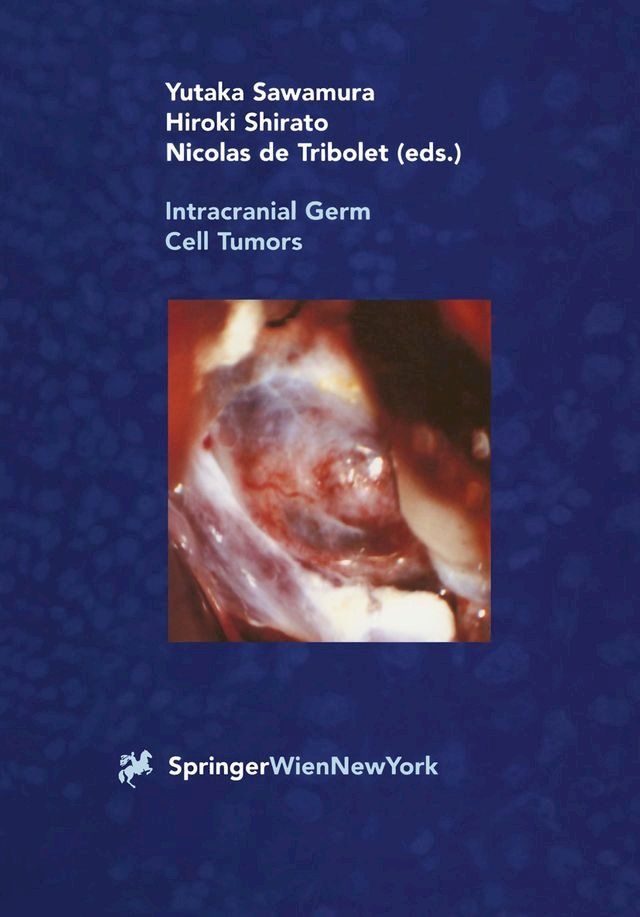  Intracranial Germ Cell Tumors(Kobo/電子書)