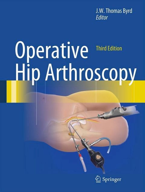 Operative Hip Arthroscopy(Kobo/電子書)