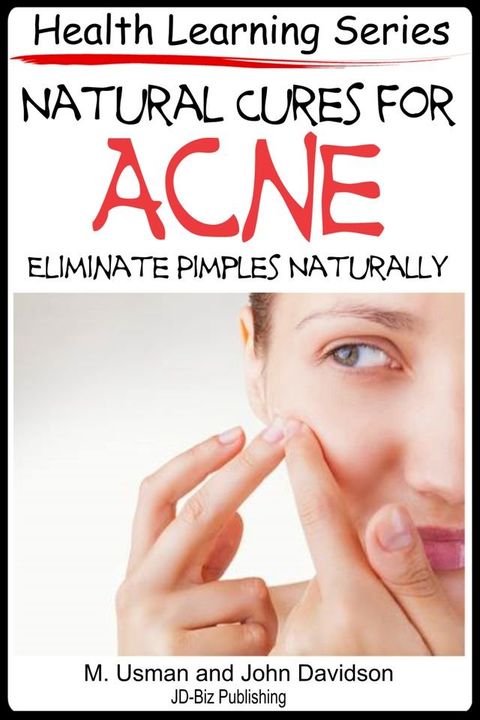 Natural Cures for Acne(Kobo/電子書)